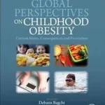 Global Perspectives on Childhood Obesity byBagchi, Debasis; Szezonális akció